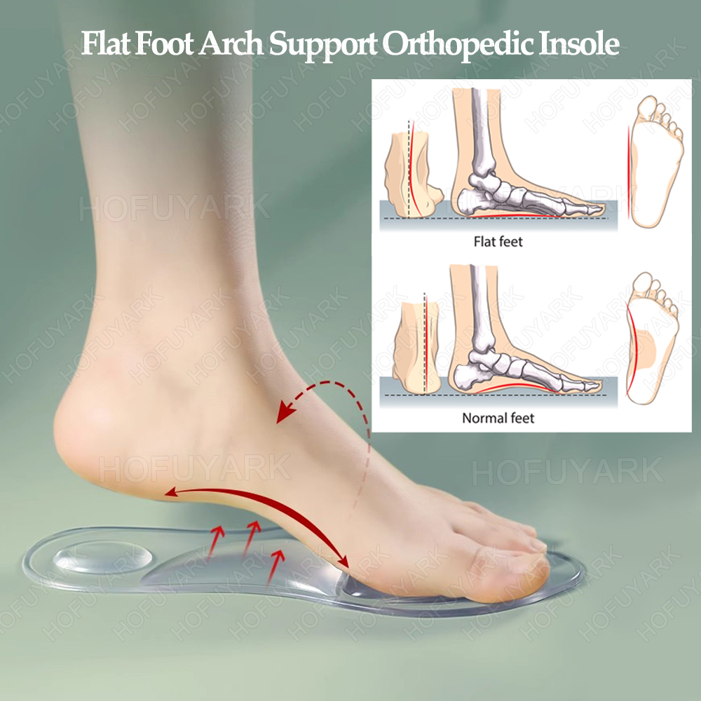 Silicone Gel Insoles Orthopedi - Women'S Shoes High Arch Support review and price